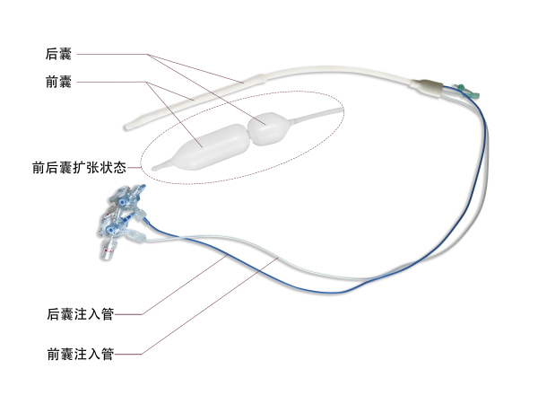 一次性使用前列腺气囊扩张导管