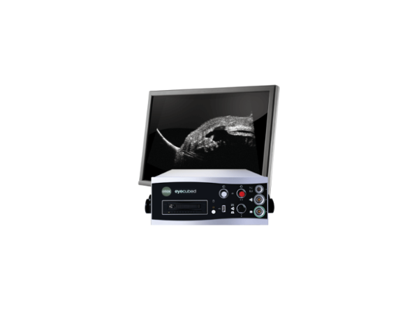 眼科AB型超声诊断仪ODU5