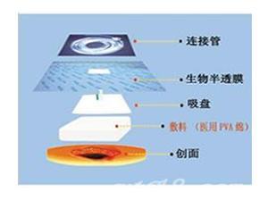 速润负压引流海绵（VSD） 负压引流  负压敷料